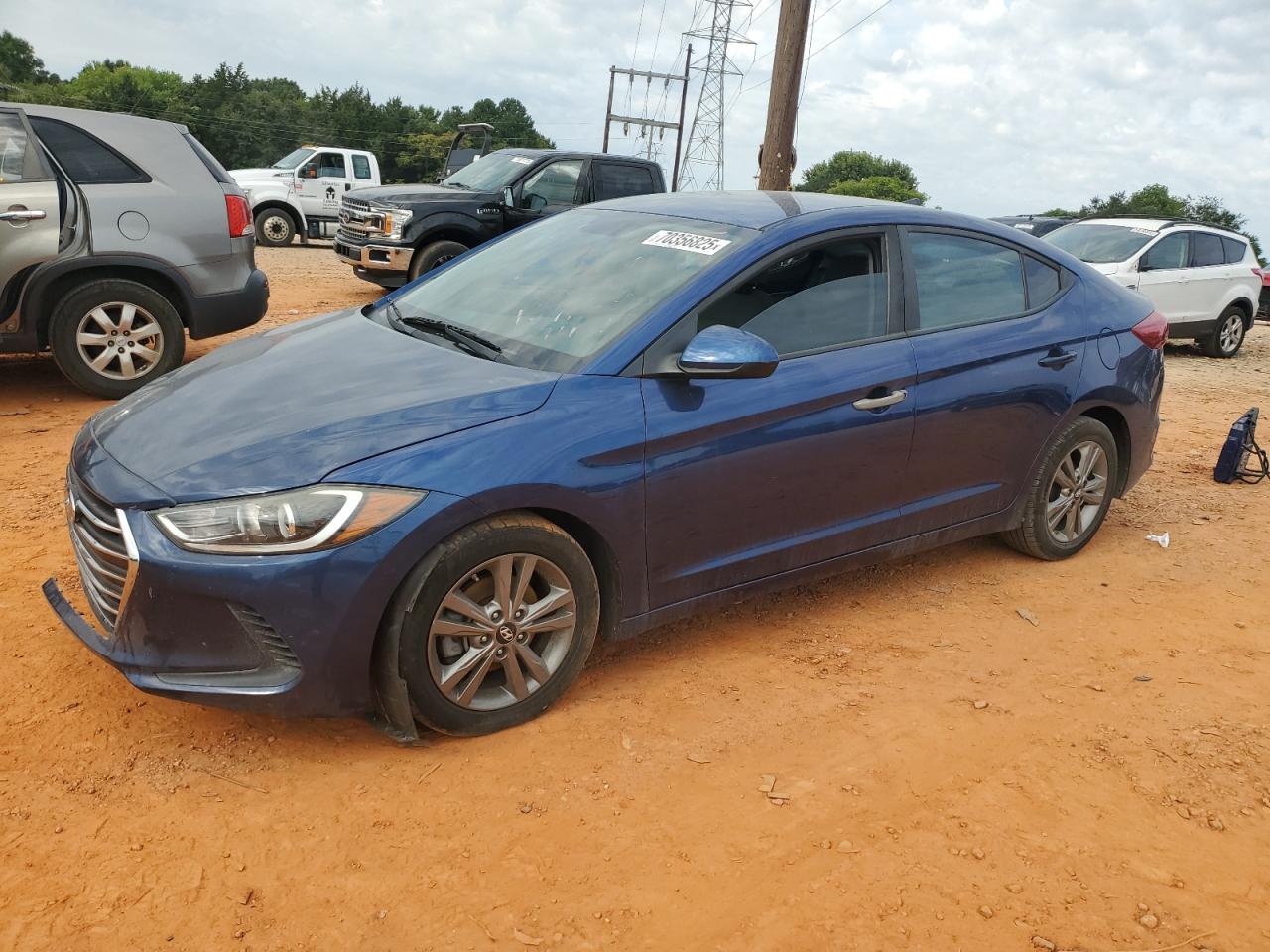 2017 Hyundai Elantra se SE