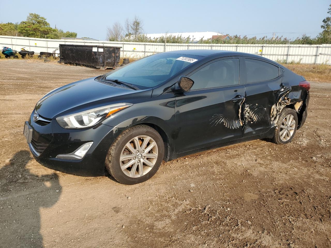 2016 Hyundai Elantra se SE